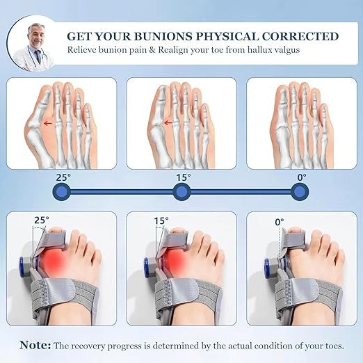 FeetifFix - Bunion Corrector