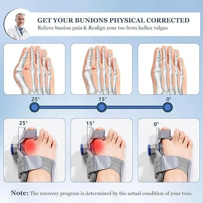 FeetifFix - Bunion Corrector